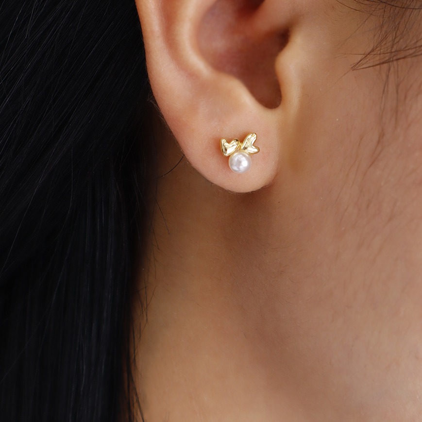 Aretes topo 7608